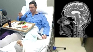 Mircea Badea, diagnostic șocant de la medici: "Sunt în prag de atac cerebral din cauza loviturilor"