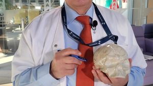 „3 din 5 persoane fac Alzheimer”. Profesorul Vlad Ciurea vorbește despre stilul de viață care influențează boala