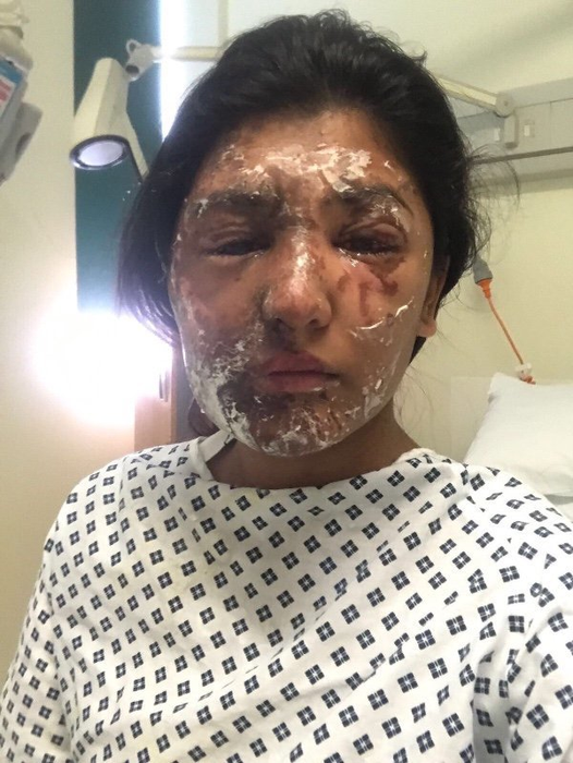 VIDEO / Voia să ajungă manechin celebru, dar soarta a lovit-o crunt! I-a aruncat cu acid sulfuric în faţă şi a distrus-o! Ce a făcut apoi agresorul