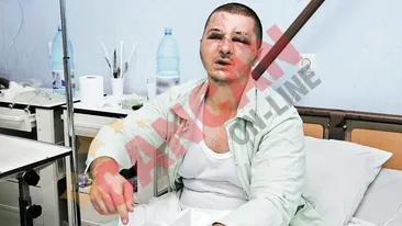 Mi-a dat cu sticla in cap pana s-a spart!