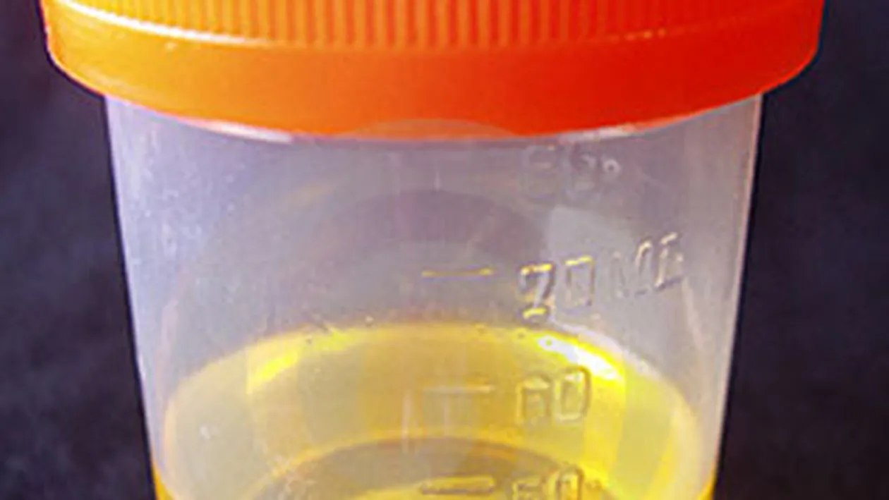 Au identificat un hot pe baza unei pungi cu urina!