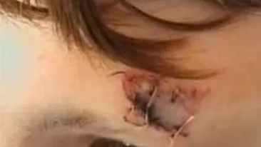 VIDEO Un elev aradean a ajuns la spital dupa ce a fost lovit de un coleg cu scaunul in cap