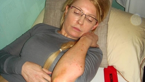 Iulia Timosenko nu a fost batuta in inchisoare, spun procurorii! Vezi cum s-a ales cu toate vanataile de pe corp!