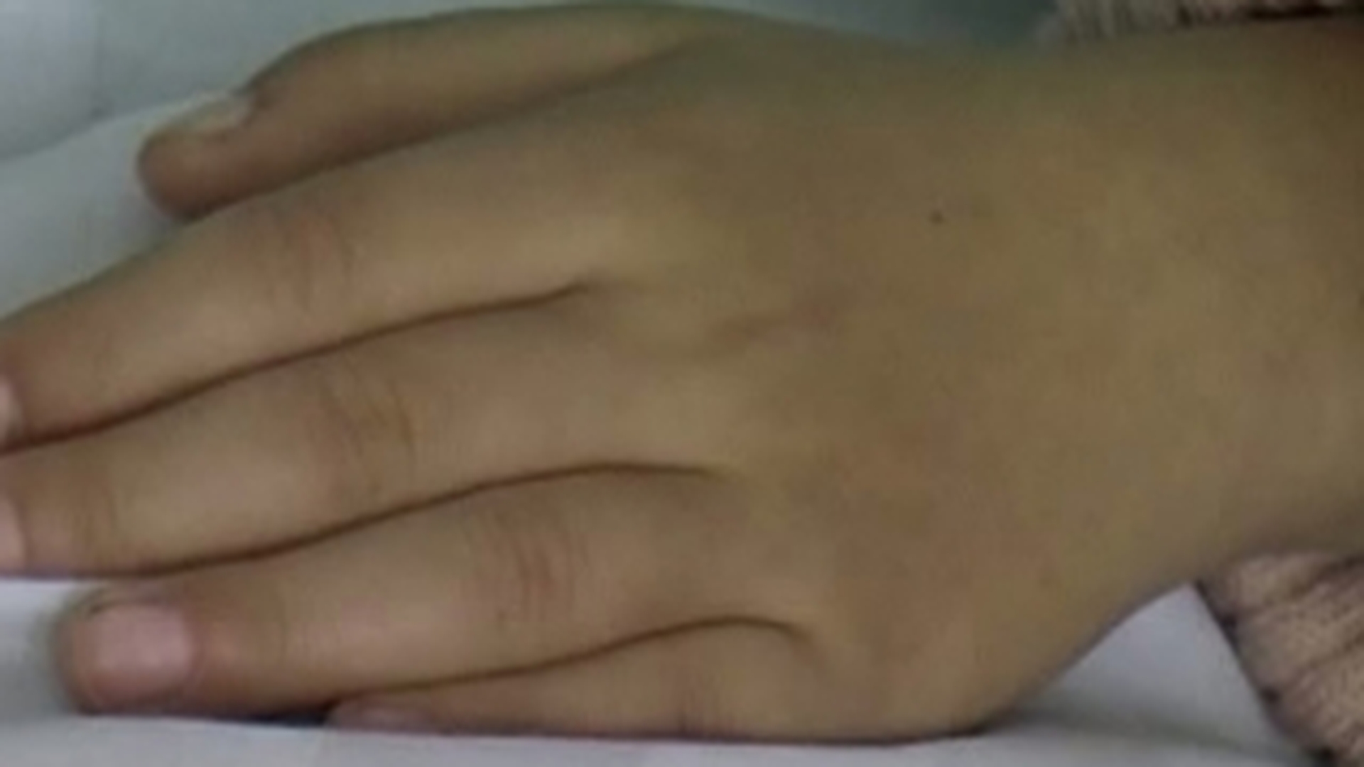 Fetita de doi ani a ajuns la spital in coma si plina de vanatai!