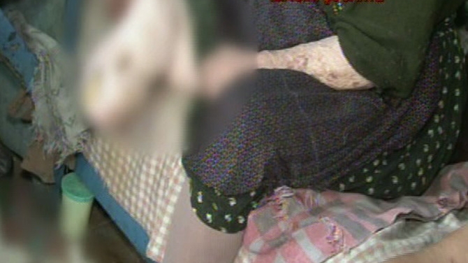 Incredibil! O batrana tine de 13 ani in podul casei o parte amputata din picior, cu care vrea sa fie ingropata: "Nu mai miroase, ca s-a uscat"