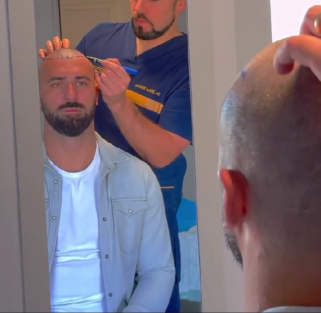 Andrei Stoica și-a făcut implant de păr/ Sursa foto: Instagram