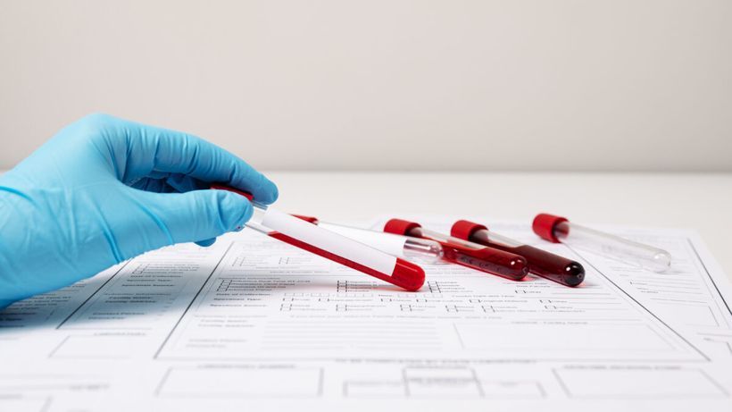 El este pacientul „zero”, care a adus lepra în Europa! De la el a pornit totul, iar autoritățile ar fi mușamalizat cazul