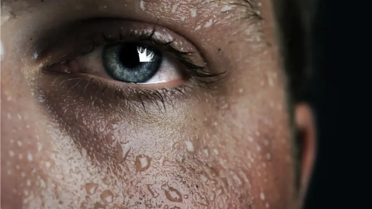 Boala care te face să plângi cu lacrimi de sânge! Este foarte rară și doar 80 de persoane a avut-o în ultimele secole