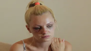 Alexandra Stan sprijină femeile bătute! Cântăreaţa se lasează intr-o campanie impotriva violentei domestice