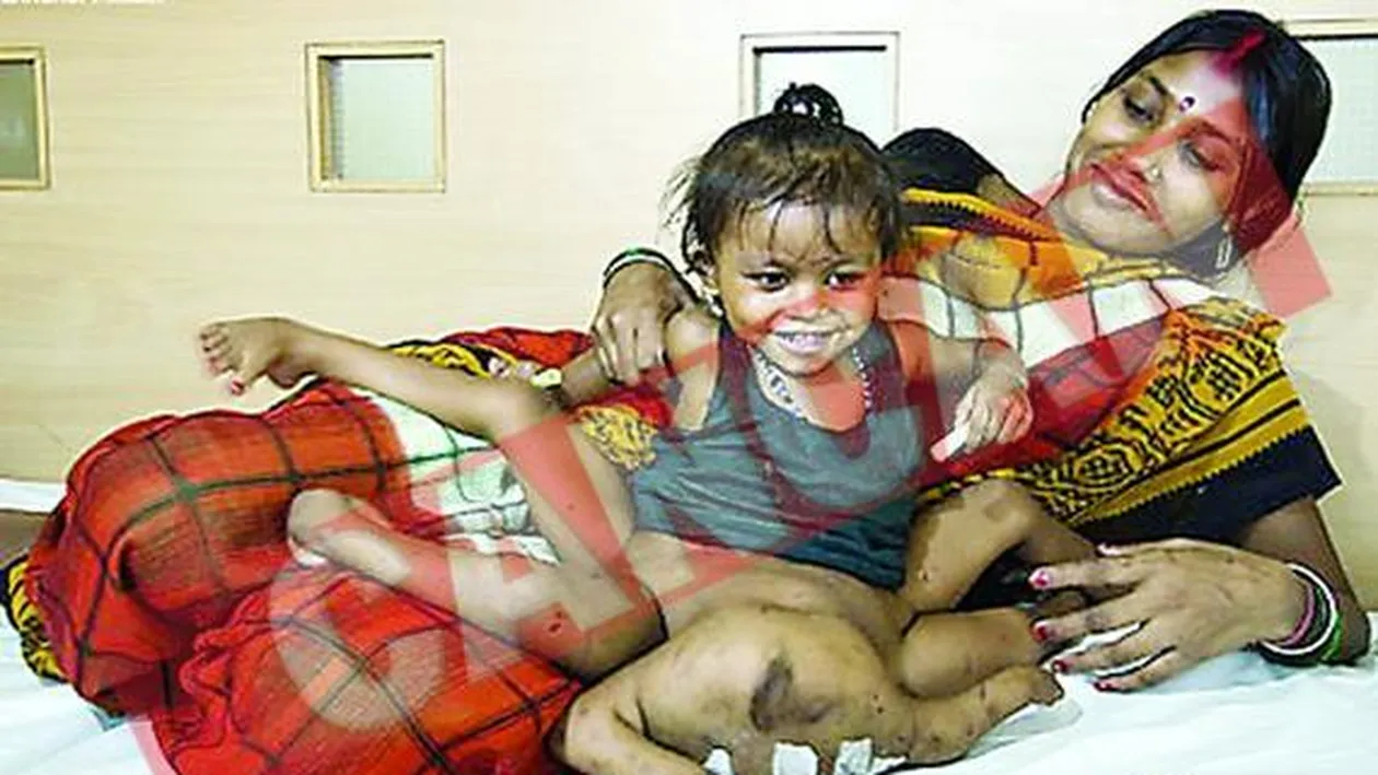 Fetita cu patru maini si patru picioare