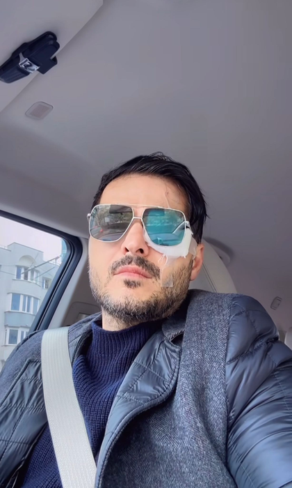 Liviu Vârciu a ajuns pe mâinile medicilor. Sursa foto: Instagram / Liviu Vârciu