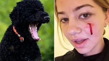 Această tânără a fost muşcată de faţă de unul dintre câinii familiei OBAMA! Totul s-a întâmplat când...