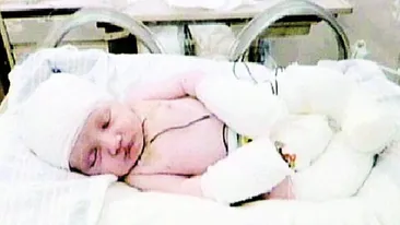 Bebelusul fara piele