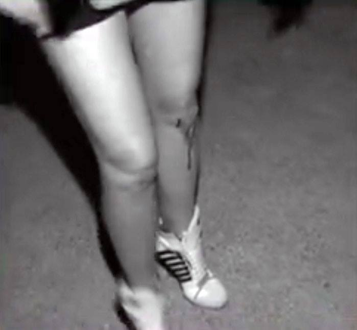 Brigitte s-a lovit la genunchi, în club la Mamaia