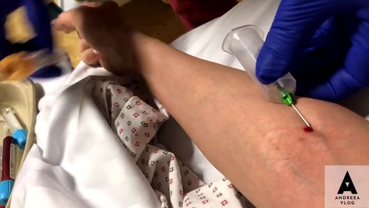 Imagini cutremurătoare! Cum arată picioarele Andreei Bălan. Cântăreața și-a dat pantalonii jos și și-a arătat rănile