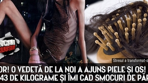 HORROR! O vedeta de la noi a ajuns piele si os! "Am doar 43 de kilograme si imi cad smocuri de par!"
