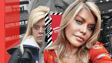 Imaginile pe care Loredana Groza le vrea șterse! Cum arăta artista înainte să fie acuzată că a trecut pe la estetician!