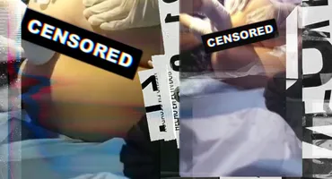 Accident de muncă terifiant la un studio de videochat din România. I-a rămas blocată jucăria sexuală în…