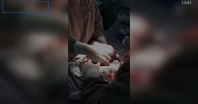Imagini emoționante în sala de operații: un băiețel s-a născut în timp ce era încă în sacul amniotic. Cazul este foarte rar: 1 la 80.000 de nașteri | FOTO & VIDEO