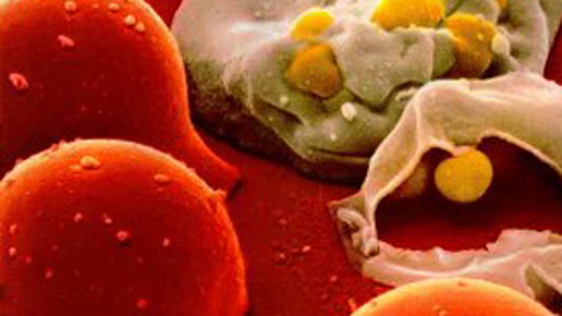 Un german a fost arestat pentru ca si-a contaminat cu HIV fosta iubita
