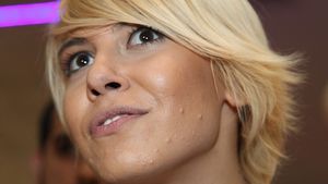 Sore, despre problemele cu acneea! Artista a dezvăluit cum a scăpat de coşuri