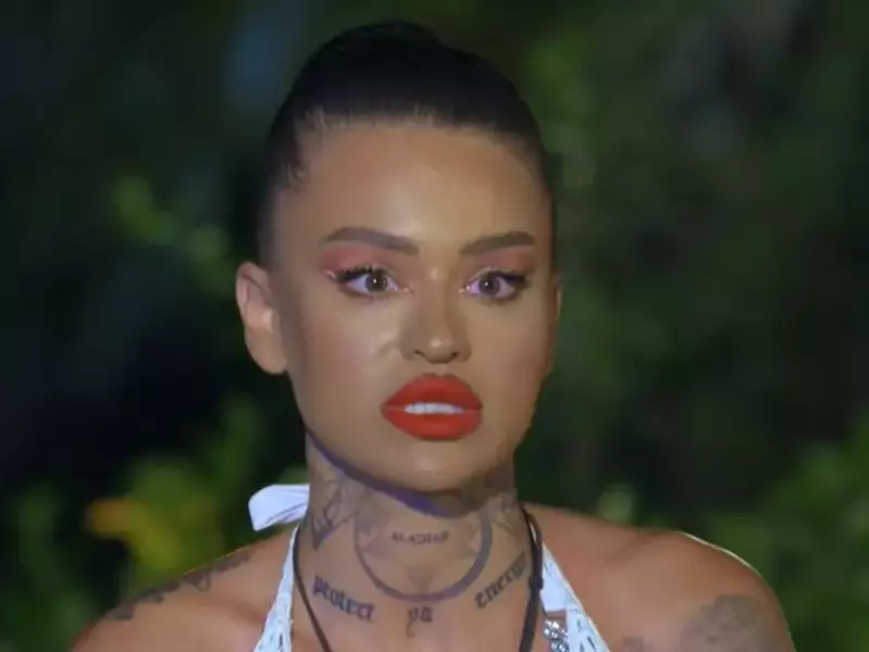 Diandra Doris a apelat la o intervenție estetică / sursa foto: captură Antena 1