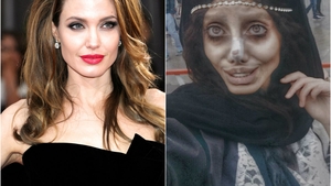 VIDEO & FOTO / O vedetă de pe Instagram a făcut 50 de operaţii estetice ca să arate precum Angelina Jolie! Rezultatul e înspăimântător şi nu are de gând să se oprească