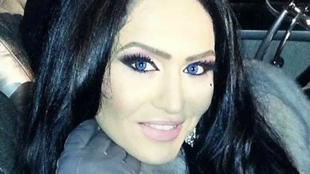 In curand o va intrece pe Bianca! Margherita din Clejani a cam exagerat cu vizitele la estetician. Uite ce buze imense si-a facut