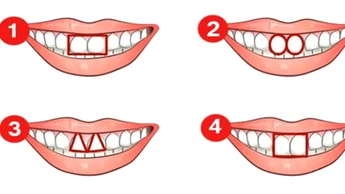 Test de personalitate inedit | Cum te caracterizează forma dinţilor? Spun totul despre tine