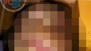 NIMENI nu se putea uita la chipul ei, pentru ca era DESFIGURATA! Cum arata ACUM tanara care semana cu un MONSTRU