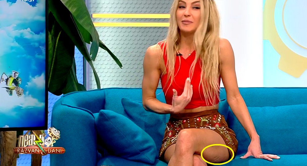 Flavia Mihășan, ”ciuruită” de celulită. A îmbrăcat o fustă prea scurtă și s-a văzut defectul