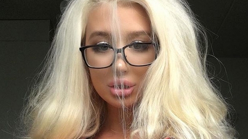 Un model care visează să devină Barbie, la un pas de moarte din cauza operaţiilor!