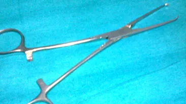 Un forceps chirurgical, uitat sase luni in abdomen, a iesit prin buricul unei femei din Franta