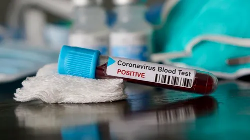 Un craiovean, asistent medical, a murit din cauza coronavirusului în timp ce se afla cu familia în concediu la mare
