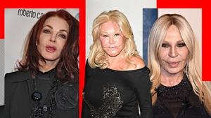TOP 5- Vedete de la Hollywood care s-au ales cu chipul desfigurat în urma operațiilor estetice. Jocelyn Wildenstein sau Donatella Versace arată de nerecunoscut!