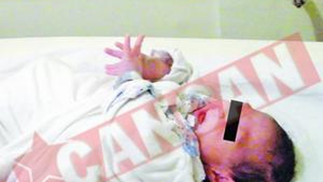 Refuza copilul pentru ca are capul prea mic