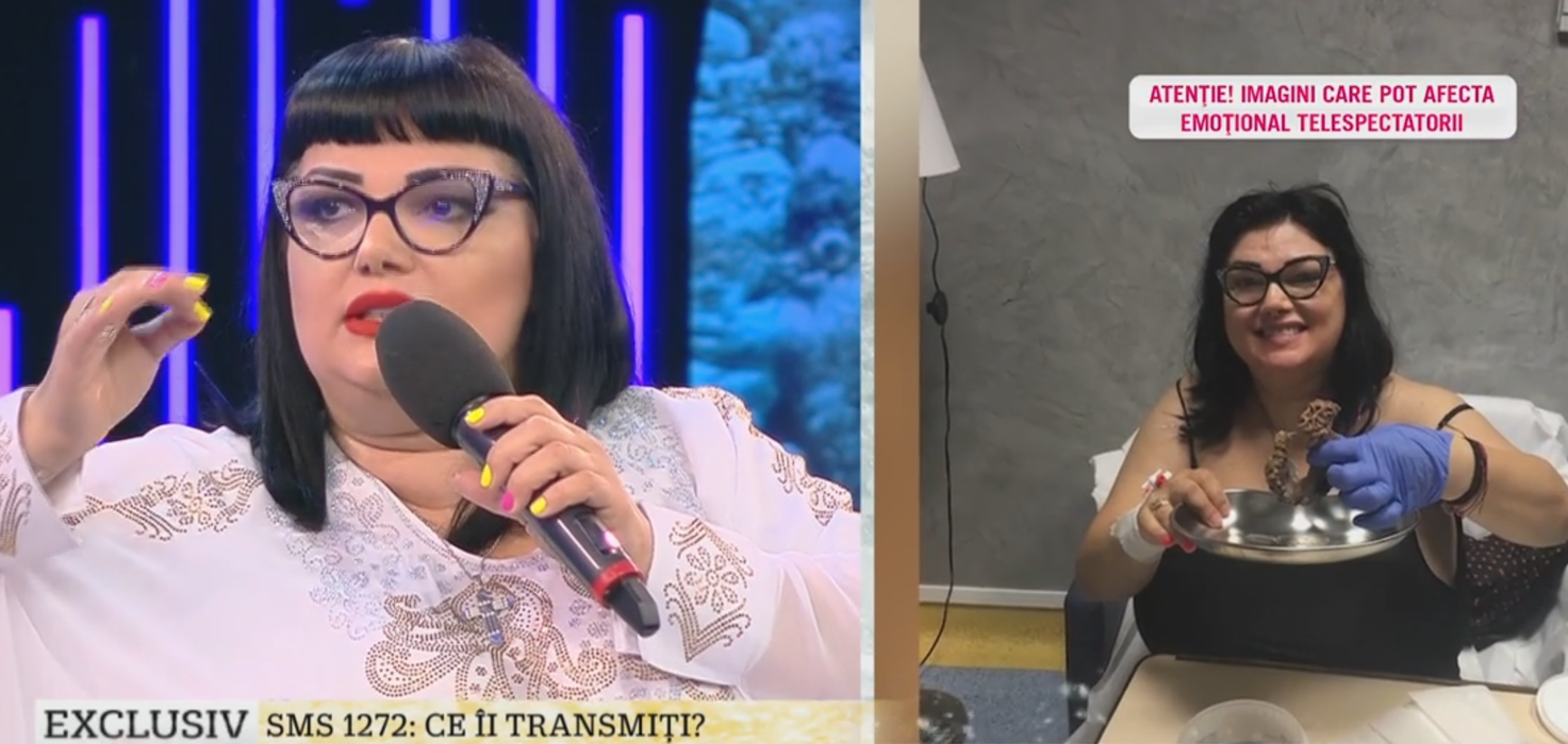 Ozana Barabancea le-a arătat tuturor stomacul ei, după operaţie