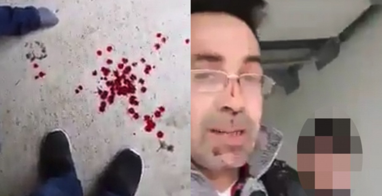 Imagini înfiorătoare! Plin de sânge, un bărbat a făcut live pe Facebook, după ce și-a înjunghiat mortal soția: „Așa sfârșești dacă îți enervezi soțul”