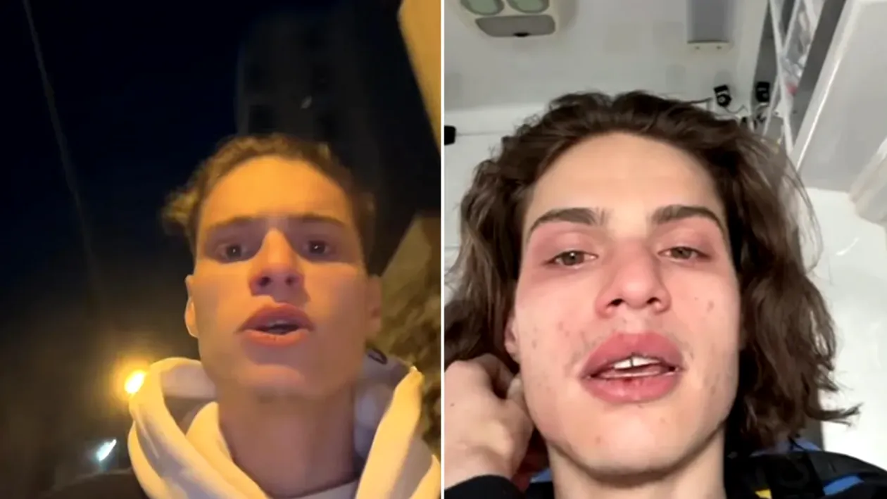 De aici a început declinul lui Rareș Ion. Evenimentul care l-a marcat profund