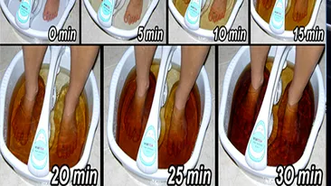 Uimitor! Cum îţi poţi detoxifia organismul prin tălpile picioarelor