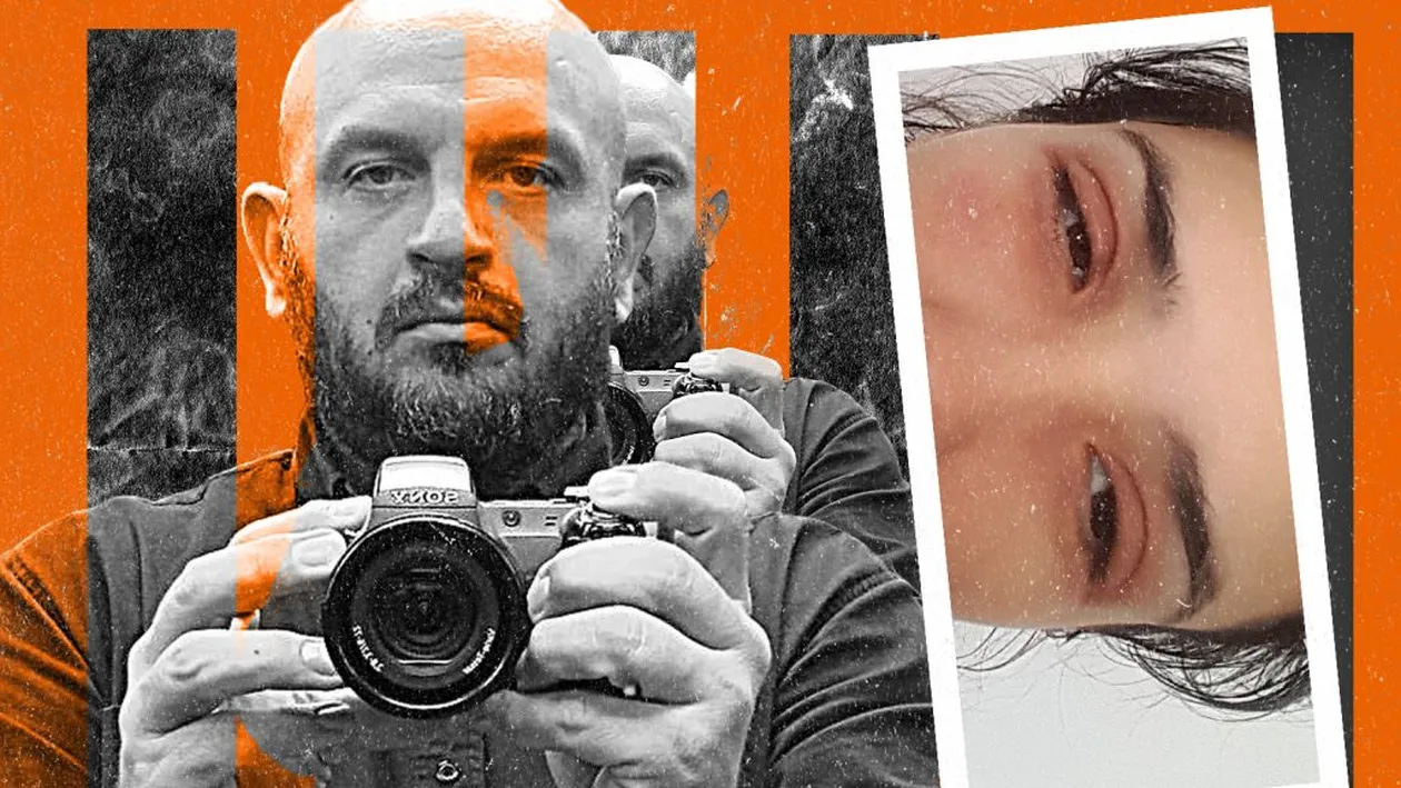 Fotomodel cunoscut, desfigurat după o prezentare de modă… Efectiv, i-a explodat fața!