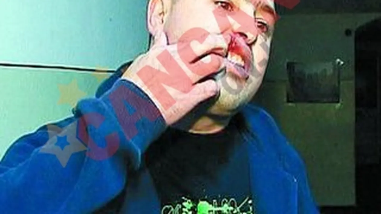 Fiul judecatoarei m-a calcat in picioare!