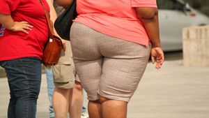 Premieră în Iași! Incredibil ce au descoperit medicii în burta unei femei care cântărește 220 de kg. Femeia avea dureri abdominale