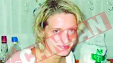 Cremele va scapa de micozele pielii!