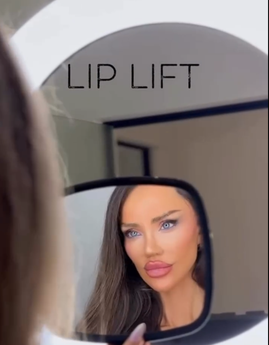 Cum arată Bianca Drăgușanu după intervenția de lip lift. A trecut aproape o lună de când și-a modificat buzele