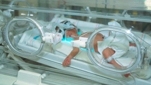 Imagini greu de privit! Medicilor nu le-a venit sa creada cand au vazut cum arata acest bebelus