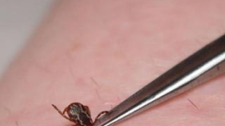Ca la noi, la nimeni! Spitalele din tara au introdus taxa pe capuse. Vezi cat vei plati daca vei avea ghinionul de a fi muscat