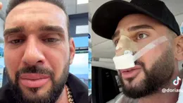 Ce probleme are Dorian Popa după operația la nas. Influencerul a recunoscut: „Nu-l simt așa încă al meu”