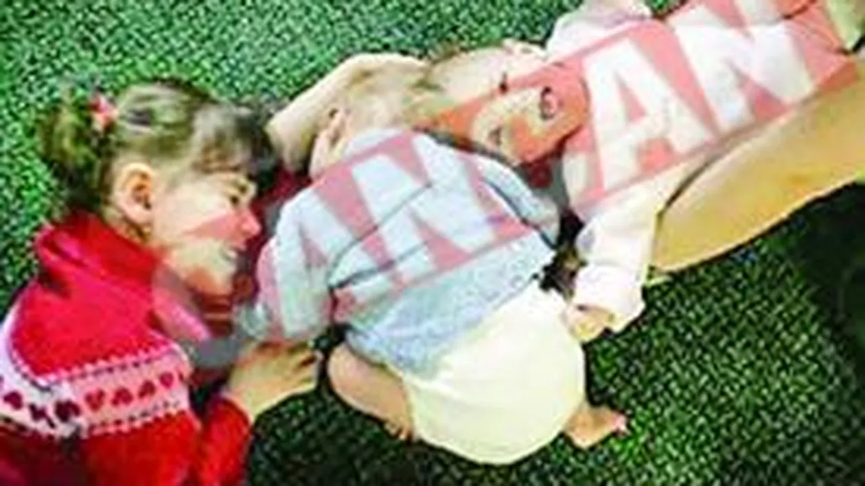 Siamezele din Romania au iesit din operatie