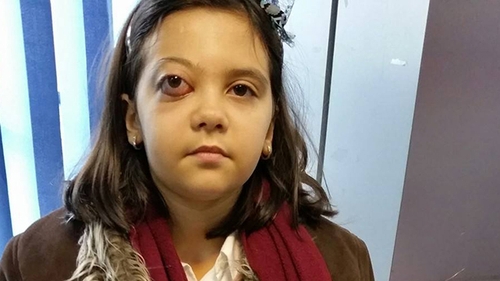 Veste cumplita pentru fetita din Iasi diagnosticata de medici cu o forma rara de cancer: "Are un ganglion la plaman"
